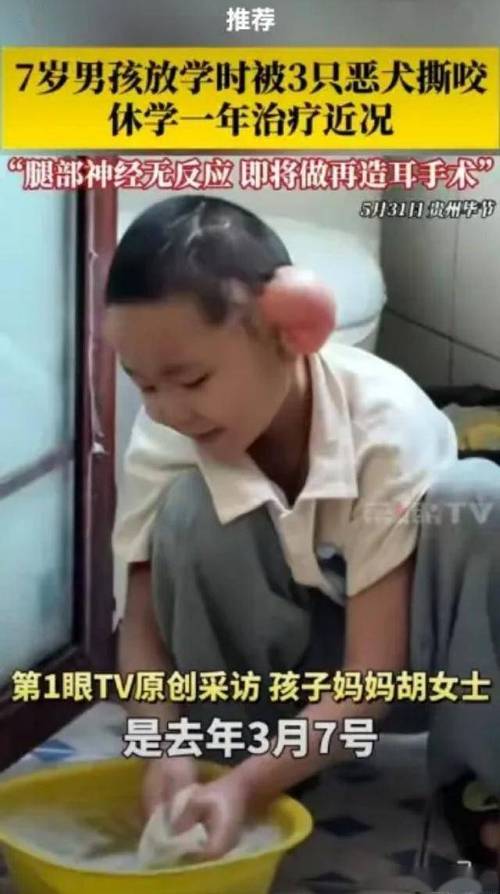 新澳今天晚上9点30分开门吗香港和7岁男孩遭3只犬撕咬与7岁男孩遭3只犬撕咬怎么办