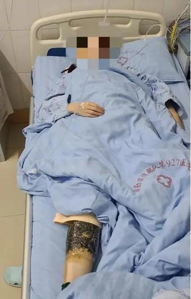 新澳2025年正版资料和被蛇咬两年仍后遗症与被蛇咬了几年后身体有毒素吗